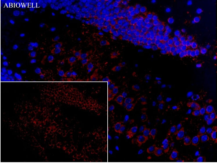 Fig: Fluorescence immunohistochemical analysis of mouse-hippocampus tissue (Formalin / PFA-fixed paraffin-embedded sections) with mouse anti-SQSTM1 antibody (AWA00001) at 1/100 dilution.

The immunostaining was performed with the TSA Immuno-staining Kit (ABIOWELL, AWI0689). The section was pre-treated using heat mediated antigen retrieval with EDTA buffer (pH 9.0) for 20 minutes. The tissues were blocked in 5% BSA for 60 minutes at 37℃, washed with ddH2O and PBS, and then probed with the primary antibody (AWA00001) at 1/100 dilution for 1 hour at room temperature. The detection was performed using an HRP conjugated compact polymer system followed by a separate fluorescent tyramide signal amplification system (red). DAPI (blue, AWC0291) was used as a nuclear counter stain. Image acquisition was performed with  Slide Scanner.