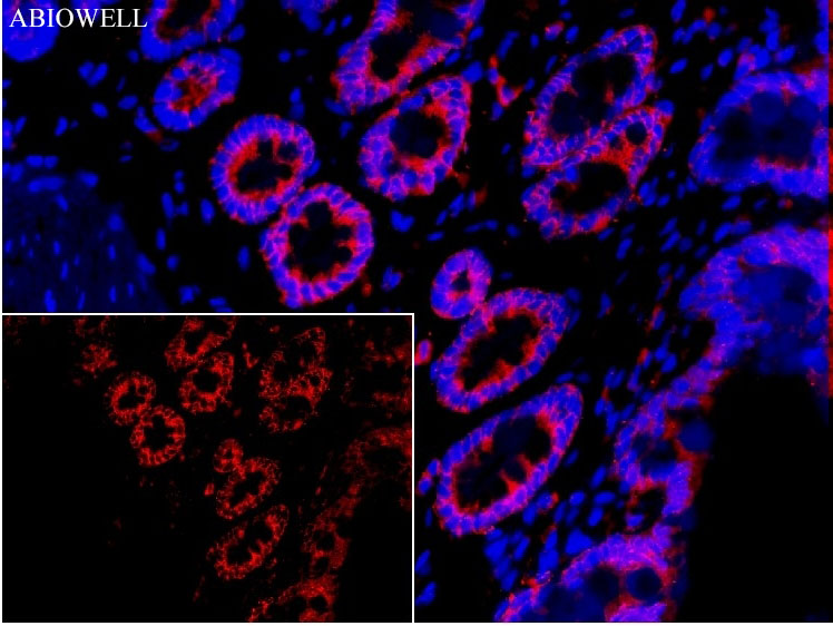 Fig: Fluorescence immunohistochemical analysis of RAT - colon tissue (Formalin / PFA-fixed paraffin-embedded sections) with mouse anti-SQSTM1 antibody (AWA00001) at 1/100 dilution.

The immunostaining was performed with the TSA Immuno-staining Kit (ABIOWELL, AWI0689). The section was pre-treated using heat mediated antigen retrieval with EDTA buffer (pH 9.0) for 20 minutes. The tissues were blocked in 5% BSA for 60 minutes at 37℃, washed with ddH2O and PBS, and then probed with the primary antibody (AWA00001) at 1/100 dilution for 1 hour at room temperature. The detection was performed using an HRP conjugated compact polymer system followed by a separate fluorescent tyramide signal amplification system (red). DAPI (blue, AWC0291) was used as a nuclear counter stain. Image acquisition was performed with  Slide Scanner.