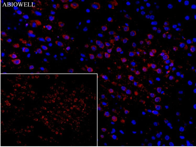 Fig: Fluorescence immunohistochemical analysis of mouse-cortex tissue (Formalin / PFA-fixed paraffin-embedded sections) with mouse anti-SQSTM1 antibody (AWA00001) at 1/100 dilution.

The immunostaining was performed with the TSA Immuno-staining Kit (ABIOWELL, AWI0689). The section was pre-treated using heat mediated antigen retrieval with EDTA buffer (pH 9.0) for 20 minutes. The tissues were blocked in 5% BSA for 60 minutes at 37℃, washed with ddH2O and PBS, and then probed with the primary antibody (AWA00001) at 1/100 dilution for 1 hour at room temperature. The detection was performed using an HRP conjugated compact polymer system followed by a separate fluorescent tyramide signal amplification system (red). DAPI (blue, AWC0291) was used as a nuclear counter stain. Image acquisition was performed with  Slide Scanner.