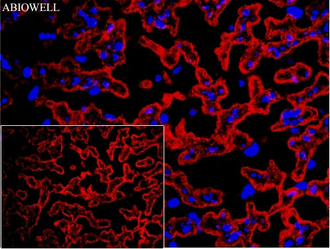 Fig: Fluorescence immunohistochemical analysis of Rat-placenta tissue (Formalin/PFA-fixed paraffin-embedded sections). with Rabbit anti-ATP1A1 antibody ( AWA11936 ) at 1/200 dilution.

The immunostaining was performed with the TSA Immuno-staining Kit (ABIOWELL, AWI0689). The section was pre-treated using heat mediated antigen retrieval with EDTA buffer (pH 9.0) for 20 minutes. The tissues were blocked in 5% BSA for 60 minutes at 37℃, washed with ddH2O and PBS, and then probed with the primary antibody (AWA11936) at 1/200 dilution for 1 hour at room temperature. The detection was performed using an HRP conjugated compact polymer system followed by a separate fluorescent tyramide signal amplification system (red). DAPI (blue, AWC0291) was used as a nuclear counter stain. Image acquisition was performed with  Slide Scanner.