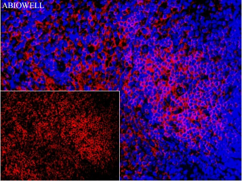 Fig: Fluorescence immunohistochemical analysis of Rat-spleen tissue (Formalin/PFA-fixed paraffin-embedded sections). with Rabbit anti-ATP1A1 antibody ( AWA11936 ) at 1/200 dilution.

The immunostaining was performed with the TSA Immuno-staining Kit (ABIOWELL, AWI0689). The section was pre-treated using heat mediated antigen retrieval with EDTA buffer (pH 9.0) for 20 minutes. The tissues were blocked in 5% BSA for 60 minutes at 37℃, washed with ddH2O and PBS, and then probed with the primary antibody (AWA11936) at 1/200 dilution for 1 hour at room temperature. The detection was performed using an HRP conjugated compact polymer system followed by a separate fluorescent tyramide signal amplification system (red). DAPI (blue, AWC0291) was used as a nuclear counter stain. Image acquisition was performed with  Slide Scanner.