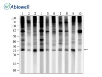 Ubiquitin Recombinant Rabbit Monoclonal Antibody