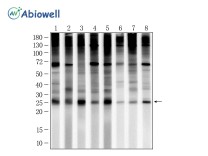 Ubiquitin Recombinant Rabbit Monoclonal Antibody