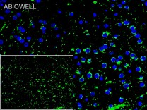 Amyloid-β Recombinant Rabbit Monoclonal Antibody