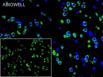 Calreticulin Recombinant Rabbit Monoclonal  Antibody