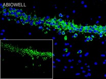 Calreticulin Recombinant Rabbit Monoclonal  Antibody