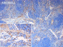 CD68 Recombinant Rabbit Monoclonal Antibody