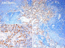 CD68 Recombinant Rabbit Monoclonal Antibody