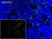 CD86 Recombinant Rabbit Monoclonal Antibody