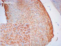 Amyloid-β 1-42 Recombinant Rabbit Monoclonal Antibody