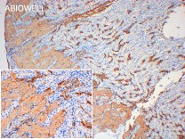 AQP1 Recombinant Rabbit Monoclonal Antibody