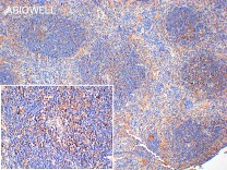 CCR7 Recombinant Rabbit Monoclonal Antibody