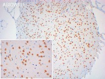 Cyclin E1 Recombinant Rabbit Monoclonal Antibody