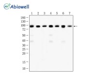 GYS1 Recombinant Rabbit Monoclonal  Antibody