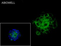 GYS1 Recombinant Rabbit Monoclonal  Antibody