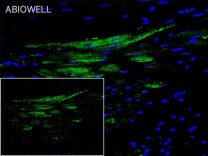 GYS1 Recombinant Rabbit Monoclonal  Antibody