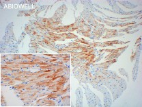 GYS1 Recombinant Rabbit Monoclonal  Antibody