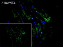 GYS1 Recombinant Rabbit Monoclonal  Antibody