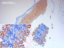 IP3R1 Recombinant Rabbit Monoclonal Antibody