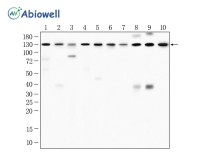 IRE1(Phospho Ser724) Recombinant Rabbit Monoclonal Antibody