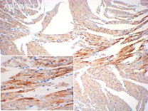 MYH1 Recombinant Rabbit Monoclonal Antibody