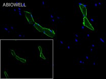 MYL2 Recombinant Rabbit Monoclonal Antibody