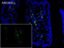 NFκB-p105/p50 Recombinant Rabbit Monoclonal Antibody