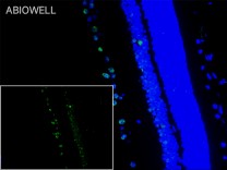 NR2F1 Recombinant Rabbit Monoclonal Antibody