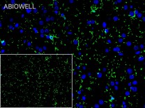 P2RY12 Recombinant Rabbit Monoclonal Antibody