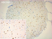 SOX10 Recombinant Rabbit Monoclonal Antibody