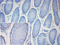 SOX10 Recombinant Rabbit Monoclonal Antibody