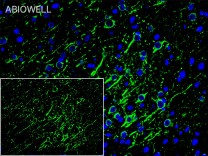 β-Tubulin Recombinant Rabbit Monoclonal Antibody