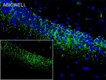 β-Tubulin Recombinant Rabbit Monoclonal Antibody