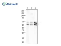 ERK1/2 (Phospho Thr202/T185) Recombinant Rabbit Monoclonal Antibody