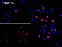 Cyclin E1 Recombinant Rabbit Monoclonal Antibody