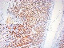 FABP1 Rabbit Polyclonal Antibody