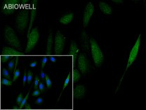 SP1 Rabbit Polyclonal Antibody