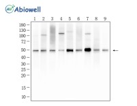 Cyclin A2 Recombinant Rabbit Monoclonal Antibody