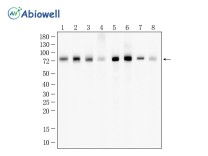 METTL3 Recombinant Rabbit Monoclonal Antibody