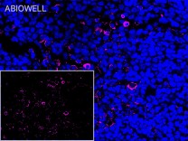 CCR7 Recombinant Rabbit Monoclonal Antibody