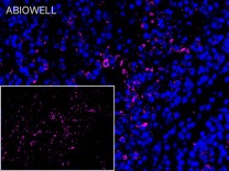 CCR7 Recombinant Rabbit Monoclonal Antibody