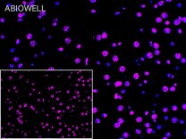 SP1 Recombinant Rabbit Monoclonal Antibody