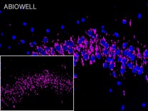 TMP21 Recombinant Rabbit Monoclonal Antibody