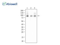 MALT1 Recombinant Rabbit Monoclonal Antibody