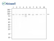 MALT1 Recombinant Rabbit Monoclonal Antibody