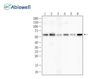 CDC7 Rabbit Polyclonal Antibody