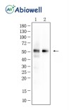 CRBN Recombinant Rabbit Monoclonal Antibody