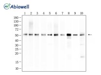 CRBN Recombinant Rabbit Monoclonal Antibody