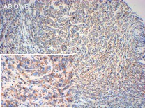 MST2 Recombinant Rabbit Monoclonal Antibody