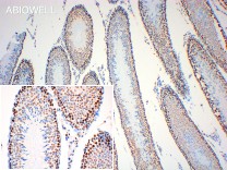 STAT3(Phospho Ser727) Recombinant Rabbit Monoclonal Antibody